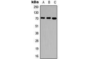 Western blot analysis of Ubiquilin 3 expression in HepG2 (A), rat brain (B), rat liver (C) whole cell lysates.