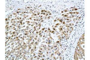 Formalin-fixed and paraffin embedded rat liver labeled with Anti-HBsAg(H2F4) Monoclonal Antibody, Unconjugated (bsm-2024M) at 1:200 followed by conjugation to the secondary antibody and DAB staining (HBSAg Antikörper)