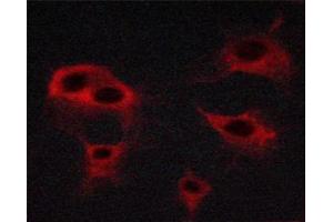 Immunofluorescence (fixed cells) (IF/ICC) image for anti-VEGF Receptor 2 (VEGFR2) (pTyr951) antibody (ABIN6256071)