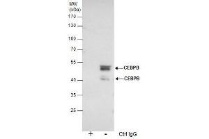 IP Image Immunoprecipitation of CEBPB protein from HeLa nuclear extracts using 5 μg of C/EBP beta antibody, Western blot analysis was performed using C/EBP beta antibody, EasyBlot anti-Rabbit IgG  was used as a secondary reagent. (CEBPB Antikörper  (N-Term))