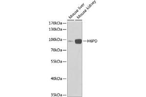 Western blot analysis of extracts of various cell lines, using H6PD Antibody (ABIN6131015, ABIN6141581, ABIN6141582 and ABIN6222086) at 1:1000 dilution. (Glucose-6-Phosphate Dehydrogenase Antikörper  (AA 20-200))
