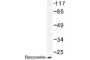 Image no. 1 for anti-Recoverin (RCVRN) antibody (ABIN272183) (Recoverin Antikörper)