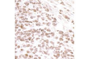 Immunohistochemistry (IHC) image for anti-Bromodomain Containing 4 (BRD4) (AA 1312-1362) antibody (ABIN7448442)