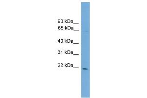 Human COLO205; WB Suggested Anti-D4S234E Antibody Titration: 0. (NSG1 Antikörper  (N-Term))