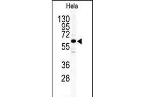Western blot analysis of anti-ILK2/ILK1 Antibody (C-term) (ABIN391105 and ABIN2837942) in Hela cell line lysates (35 μg/lane). (ILK Antikörper  (C-Term))