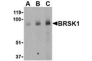 Western blot analysis of BRSK1 in human brain tissue lysate with AP30167PU-N BRSK1 antibody at (A) 0. (BRSK1 Antikörper  (Center))