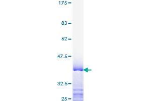 MED1 Protein (AA 1391-1490) (GST tag)