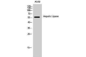 Western Blotting (WB) image for anti-Lipase, Hepatic (LIPC) (Internal Region) antibody (ABIN3184996) (LIPC Antikörper  (Internal Region))