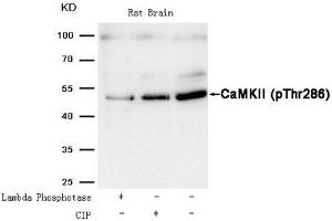 Western blot analysis of extracts from Rat brain tissue treated with Lambda Phosphotase or calf intestinal phosphatase (CIP),using CaMKII (Phospho-Thr286) Antibody. (CAMK2A Antikörper  (pThr286))