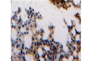 Used in DAB staining on fromalin fixed paraffin-embedded Lung tissue (ESM1 Antikörper  (AA 20-184))