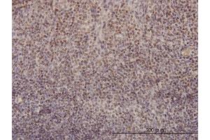 Immunostaining (ISt) image for anti-Replication Factor C (Activator 1) 4, 37kDa (RFC4) (AA 254-363) antibody (ABIN562635)