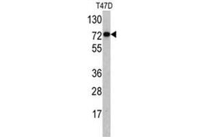 Western blot analysis of PID/MTA2 antibody (C-term) in T47D cell line lysates (35ug/lane). (MTA2 Antikörper  (C-Term))