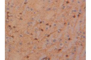 DAB staining on IHC-P; Samples: Rat Glioma Tissue (TIMP4 Antikörper  (AA 40-224))