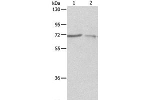 Western Blot analysis of A375 and A431 cell using SH-PTP1 Polyclonal Antibody at dilution of 1:500 (SHP1 Antikörper)