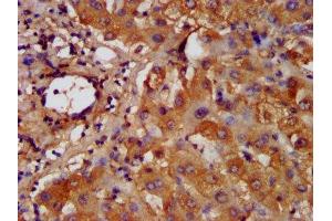 IHC image of ABIN7155245 diluted at 1:200 and staining in paraffin-embedded human liver tissue performed on a Leica BondTM system. (HAL Antikörper  (AA 36-152))