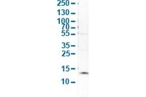 Western Blot analysis of human cell line SK-BR-3.
