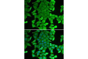 Immunofluorescence analysis of MCF-7 cells using RFFL antibody (ABIN6292254). (RFFL Antikörper)