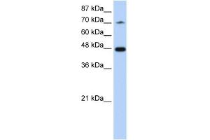 WB Suggested Anti-SF3B4 Antibody Titration:  1. (SF3B4 Antikörper  (N-Term))