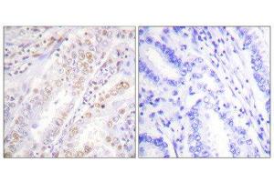 Immunohistochemistry (IHC) image for anti-X-Ray Repair Complementing Defective Repair in Chinese Hamster Cells 2 (XRCC2) (C-Term) antibody (ABIN1848896) (XRCC2 Antikörper  (C-Term))