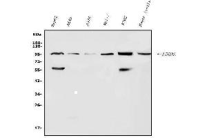 Western blot analysis of ATG9A using anti-ATG9A antibody (ABIN7599557).