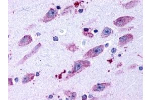 Immunohistochemical staining of Brain (Neurons and glia) using anti- DRD4 antibody ABIN122473 (DRD4 Antikörper  (C-Term))