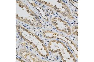 Immunohistochemistry of paraffin-embedded human kidney using EIF4E antibody at dilution of 1:200 (x400 lens) (EIF4E Antikörper  (AA 1-100))