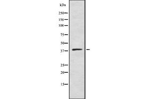 Western blot analysis of DHHC-9 using COLO205 whole cell lysates (ZDHHC9 Antikörper  (C-Term))