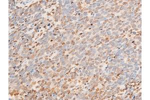 Immunohistochemistry (IHC) image for anti-Janus Kinase 1 (JAK1) (pTyr1022), (pTyr1023) antibody (ABIN6255762)