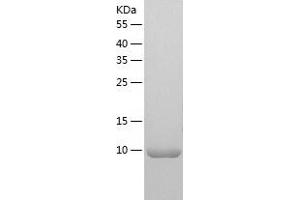 Chemokine (C-C Motif) Ligand 24 (CCL24) (AA 27-119) protein (His-IF2DI Tag)