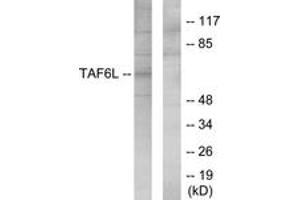 Western blot analysis of extracts from 293 cells, using TAF6L Antibody. (TAF6L Antikörper  (AA 31-80))