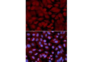 Immunofluorescence (IF) image for anti-O-Linked N-Acetylglucosamine (GlcNAc) Transferase (UDP-N-Acetylglucosamine:polypeptide-N-Acetylglucosaminyl Transferase) (OGT) antibody (ABIN1874000)