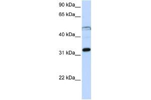 WB Suggested Anti-EIF3G Antibody Titration:  0.