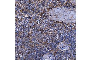 IHC analysis of Septin 11/SEPTIN11 using anti-Septin 11/SEPTIN11 antibody (ABIN7602925). (Septin 11 Antikörper  (C-Term))