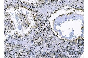 IHC analysis of FOXK1 using anti-FOXK1 antibody (ABIN7600295). (Foxk1 Antikörper  (AA 175-671))