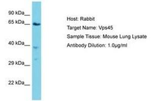 Image no. 1 for anti-Vacuolar Protein Sorting 45 (VPS45) (AA 468-517) antibody (ABIN6750334)