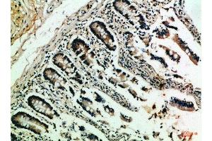 Immunohistochemical analysis of paraffin-embedded Human-colon, antibody was diluted at 1:100 (NFAT1 Antikörper  (AA 640-700))