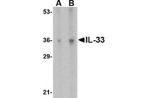 Western blot analysis of IL-33 in human lymph node tissue lysate with AP30426PU-N IL-33 antibody at (A) 1 and (B) 2 μg/ml. (IL-33 Antikörper  (N-Term))