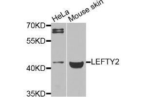 Western blot analysis of extracts of various cells, using LEFTY2 antibody.