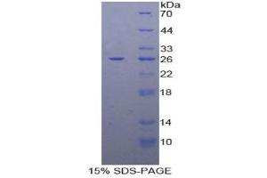 SDS-PAGE (SDS) image for Dihydrolipoamide Dehydrogenase (DLD) (AA 280-487) protein (His tag) (ABIN1879604) (DLD Protein (AA 280-487) (His tag))