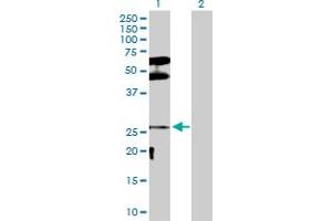 Western Blot analysis of DLX3 expression in transfected 293T cell line by DLX3 MaxPab polyclonal antibody. (DLX3 Antikörper  (AA 1-287))