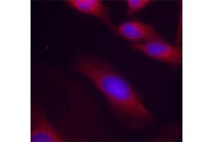 Immunofluorescence staining of methanol-fixed HeLa cells using Phospho-RELA-S536 antibody (ABIN2987368). (NF-kB p65 Antikörper  (pSer536))