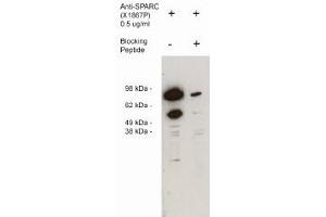 Image no. 1 for anti-Secreted Protein, Acidic, Cysteine-Rich (Osteonectin) (SPARC) antibody (ABIN265179) (SPARC Antikörper)