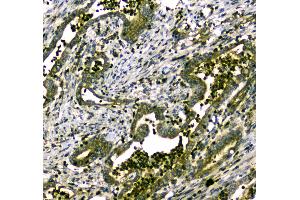 Immunohistochemistry (IHC) image for anti-Myosin Binding Protein C, Cardiac (MYBPC3) (AA 1070-1123) antibody (ABIN5693035)