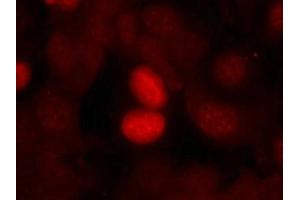 Immunofluorescence staining of methanol-fixed MCF7 cells using FKHR(Phospho-Ser256) Antibody.
