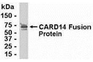 Western Blotting (WB) image for anti-Caspase Recruitment Domain Family, Member 14 (CARD14) (AA 221-330) antibody (ABIN2468032) (CARD14 Antikörper  (AA 221-330))
