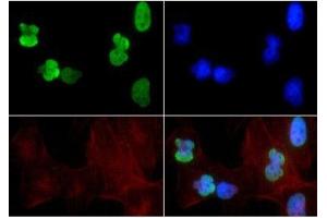 Fluorescence Microscopy (FM) image for anti-Histone 3 (H3) (H3K14ac), (H3K9ac) antibody (ABIN5706782)