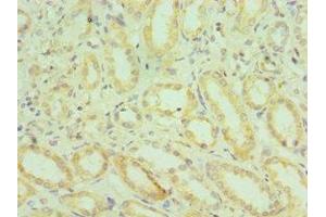 Immunohistochemistry of paraffin-embedded human kidney tissue using ABIN7155971 at dilution of 1:100 (HYAL2 Antikörper  (AA 367-473))