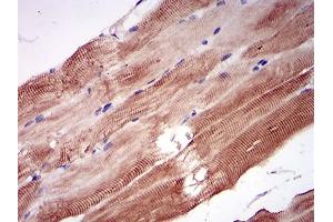 Immunohistochemistry (IHC) image for anti-Niemann-Pick Disease, Type C1 (NPC1) (AA 34-174) antibody (ABIN1724876)