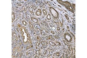 IHC analysis of DLAT using anti-DLAT antibody (ABIN7602307). (DLAT Antikörper  (AA 69-642))