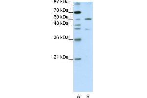 WB Suggested Anti-ZNF496 Antibody Titration:  1. (ZNF496 Antikörper  (N-Term))